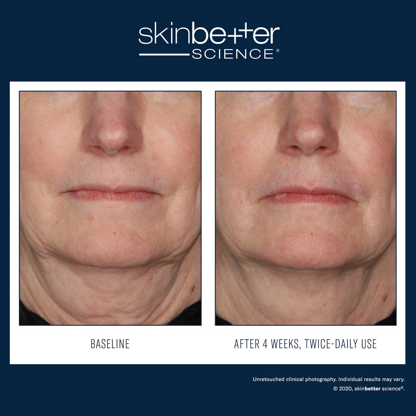 SkinBetter InterFuse Treatment Cream FACE & NECK 30ml