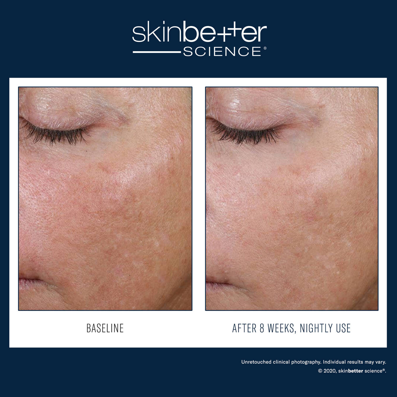 SkinBetter AlphaRet Overnight Cream 30ml