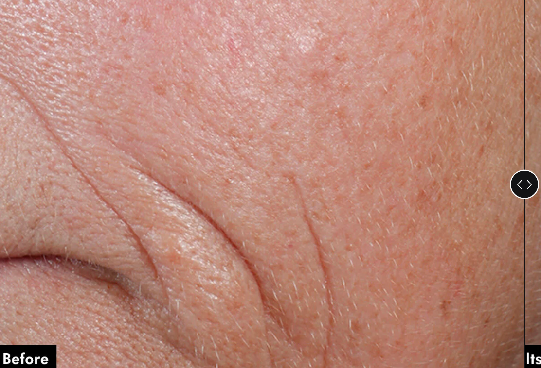 C E Ferulic with 15% l-ascorbic acid