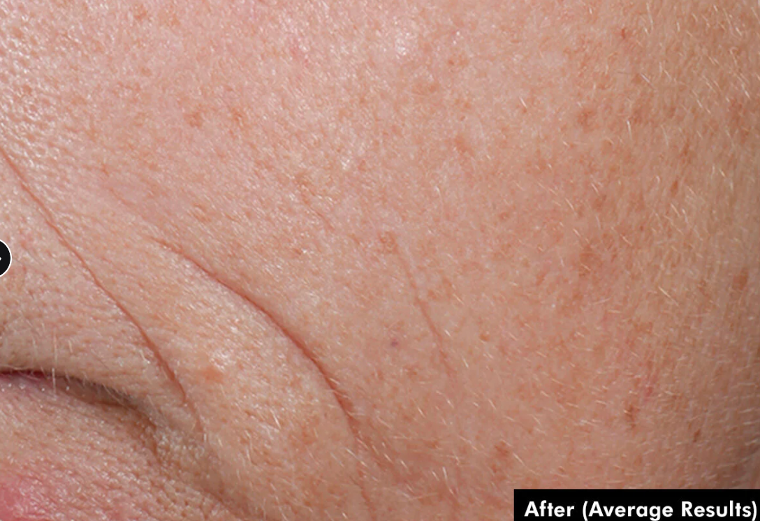 C E Ferulic with 15% l-ascorbic acid